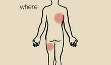 十八岁患癌女生：癌痛到底有多痛？