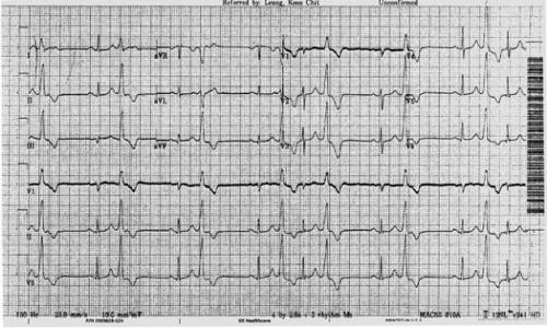 一句话的多样性