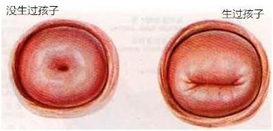 对于未出生的婴儿