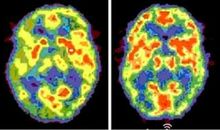 人类的大脑读后感